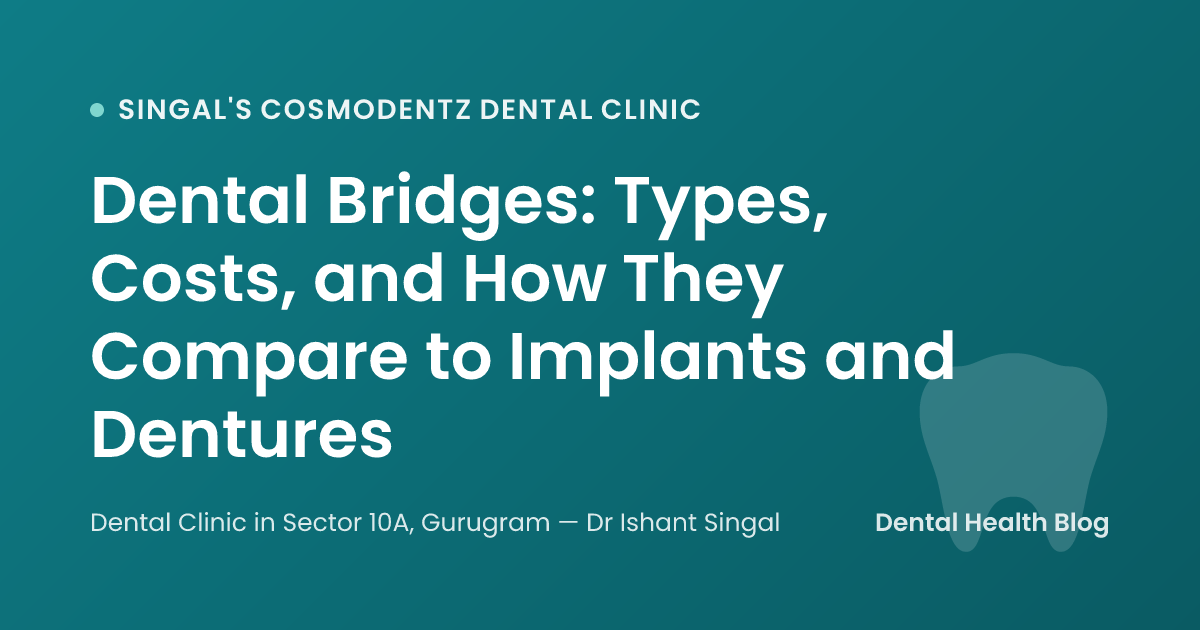 Dental Bridges: Types, Costs, and How They Compare to Implants and Dentures
