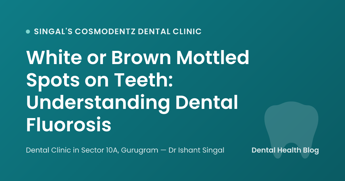 White or Brown Mottled Spots on Teeth: Understanding Dental Fluorosis