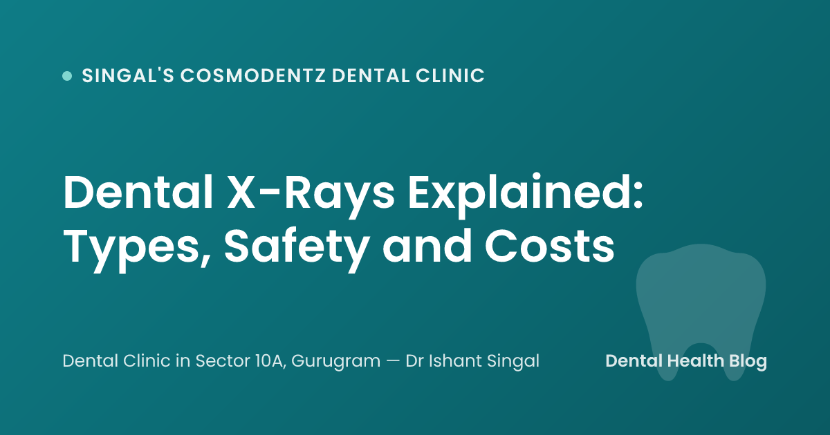 Dental X-Rays Explained: Types, Safety and Costs