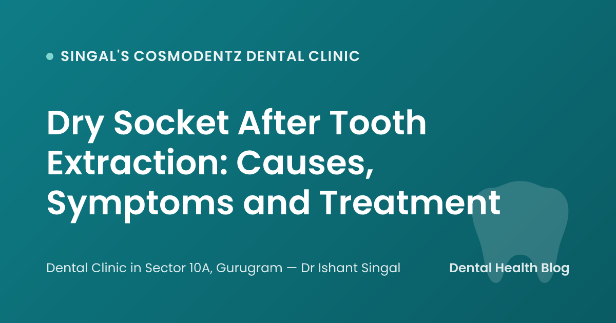 Dry Socket After Tooth Extraction: Causes, Symptoms and Treatment