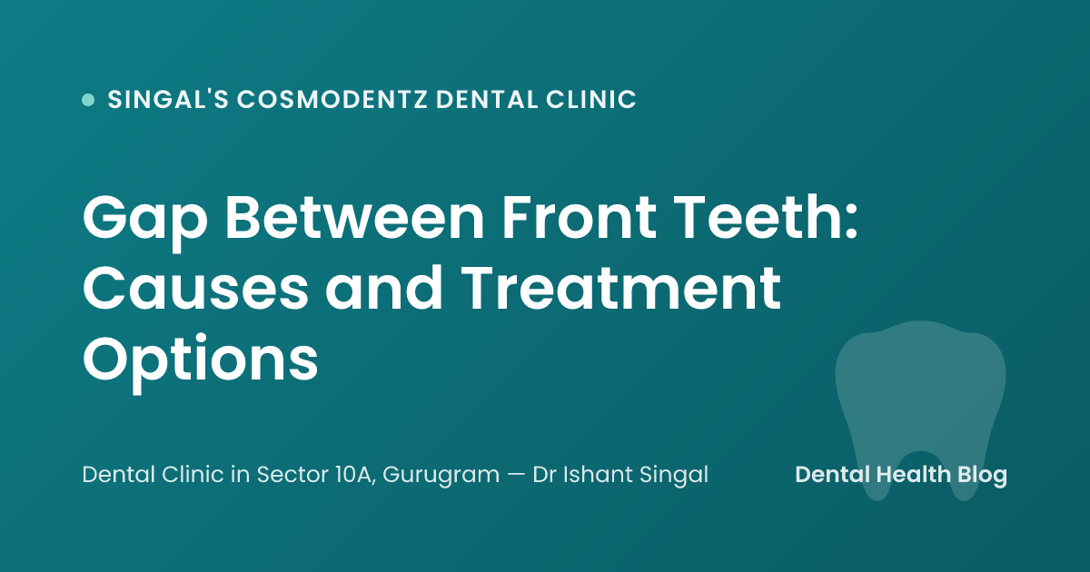 Gap Between Front Teeth: Causes and Treatment Options