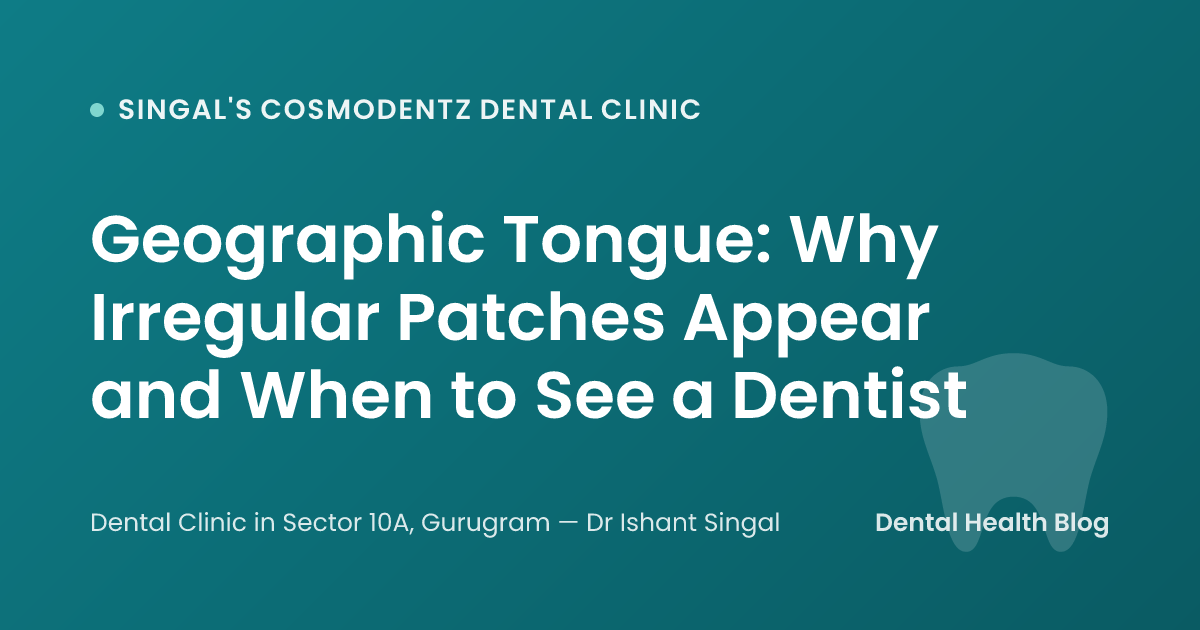 Geographic Tongue: Why Irregular Patches Appear and When to See a Dentist