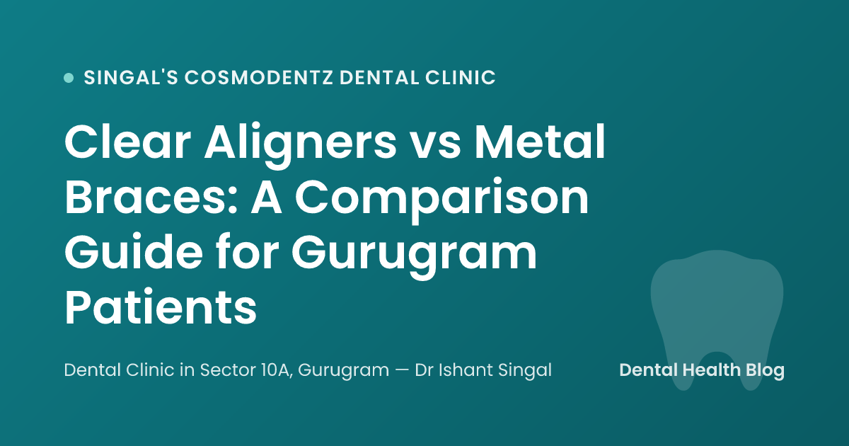 Clear Aligners vs Metal Braces: A Comparison Guide for Gurugram Patients