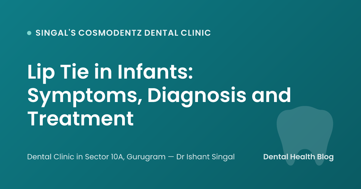 Lip Tie in Infants: Symptoms, Diagnosis and Treatment