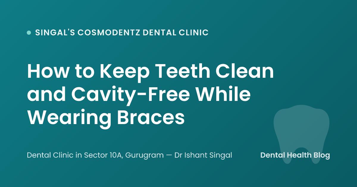 How to Keep Teeth Clean and Cavity-Free While Wearing Braces