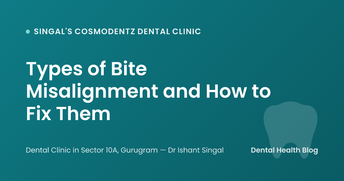 Types of Bite Misalignment and How to Fix Them