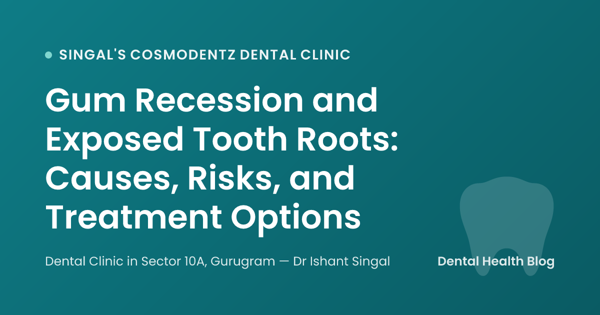 Gum Recession and Exposed Tooth Roots: Causes, Risks, and Treatment Options