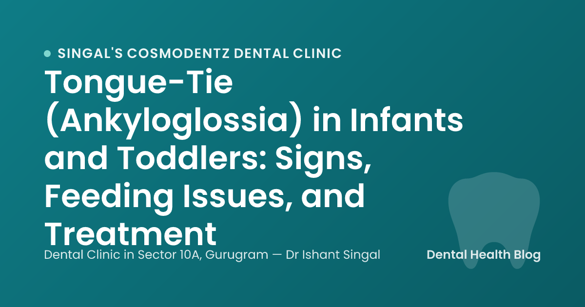 Tongue-Tie (Ankyloglossia) in Infants and Toddlers: Signs, Feeding Issues, and Treatment