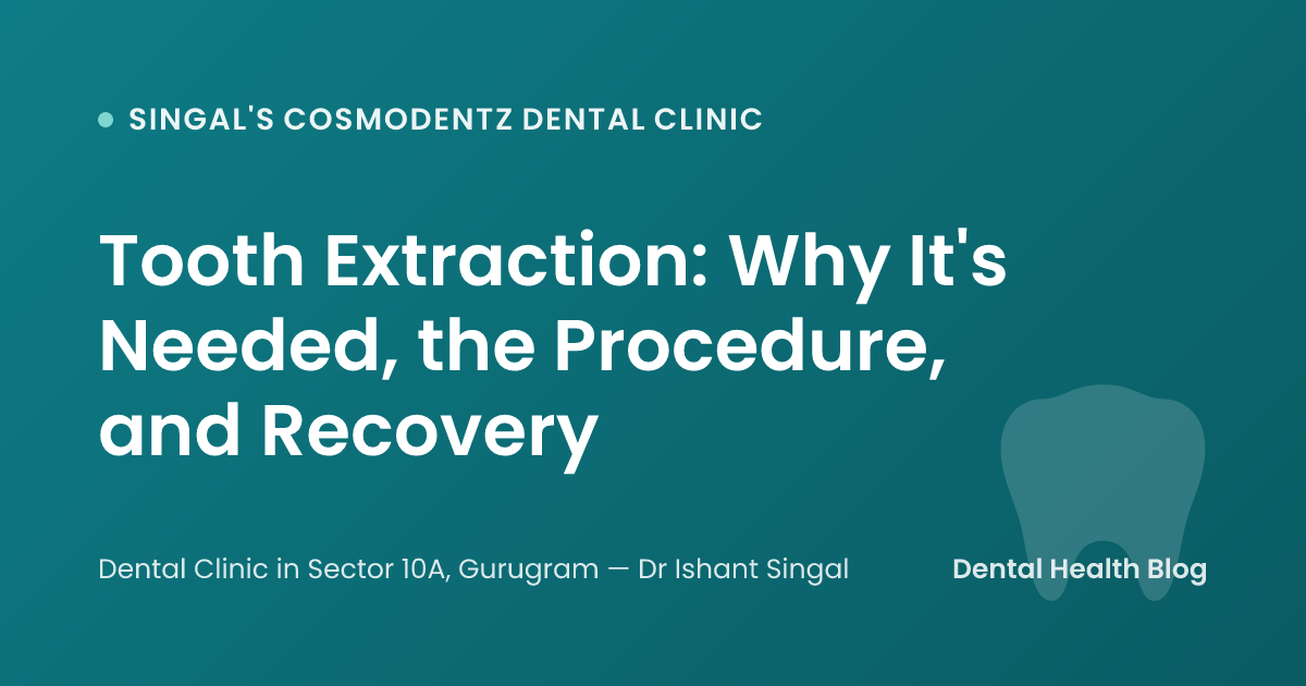Tooth Extraction: Why It's Needed, the Procedure, and Recovery