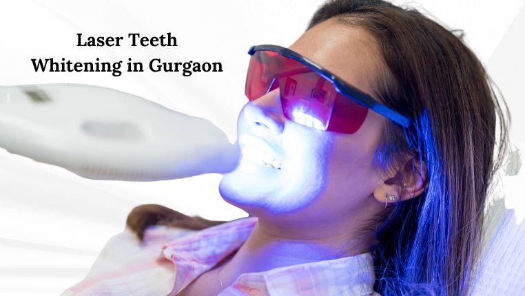 laser teeth whitening in Gurgaon