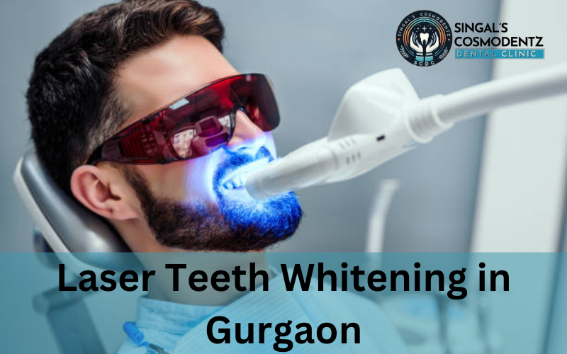 laser teeth whitening in gurgaon