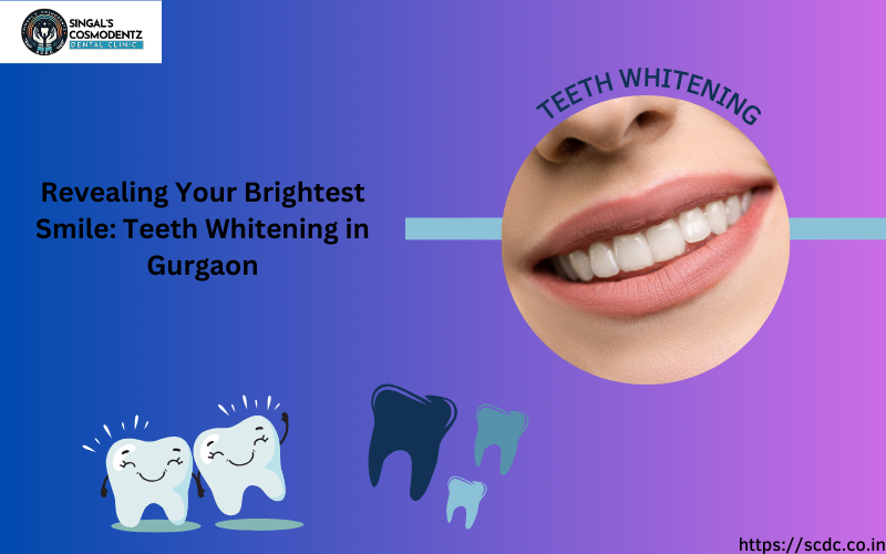 Teeth Whitening in Gurgaon