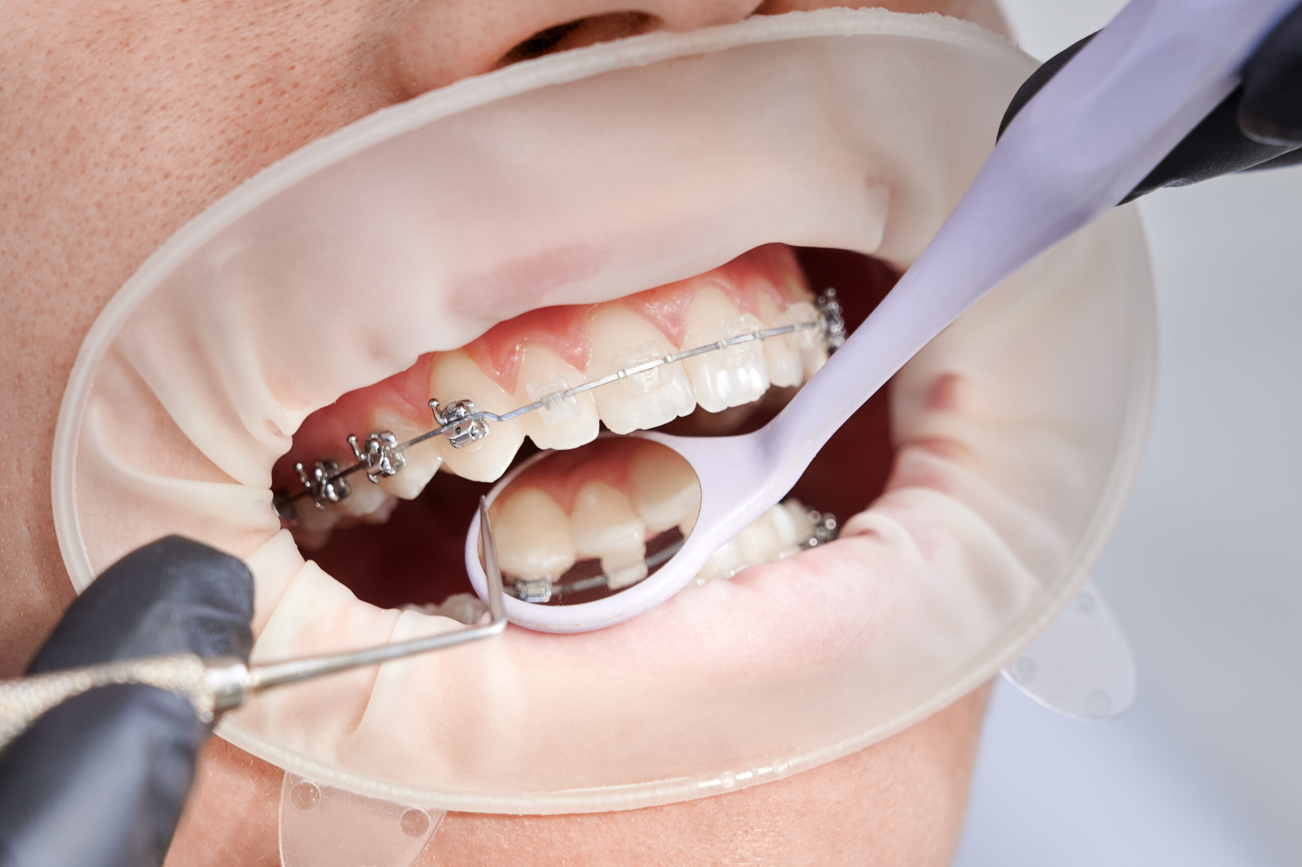 Best Orthodontist in Gurgaon