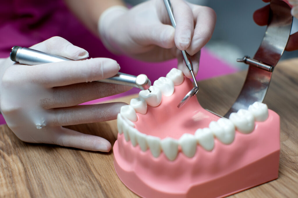 Dental Crowns in Gurgaon: Expert Care