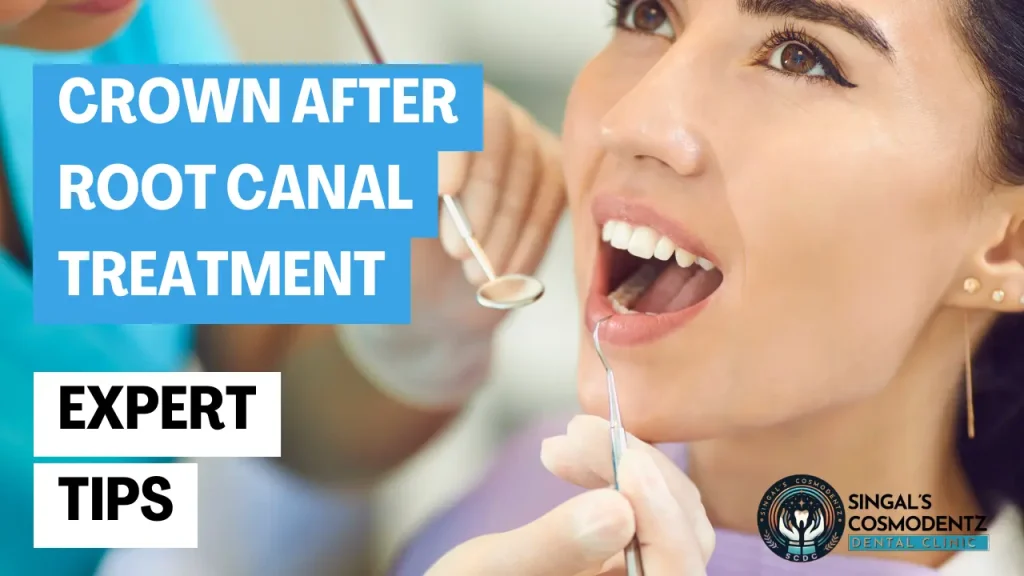 Patient receiving dental care with expert tips on crown after RCT at Singal’s Cosmodentz Dental Clinic.