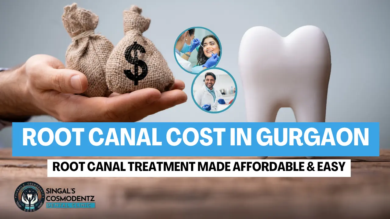 Root Canal Treatment Cost in Gurgaon with affordable dental care and expert dentists at Singal’s Cosmodentz Dental Clinic.