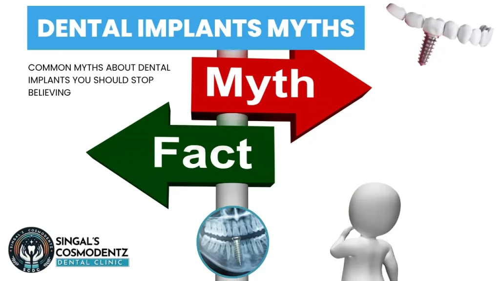 Illustration showing myth vs fact signs highlighting common dental implant myths with implant graphics, used for a dental implants awareness blog by SCDC.