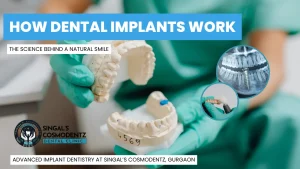 Dentist demonstrating dental implant model and X-ray at Singal’s Cosmodentz Dental Clinic, Gurgaon — explaining how dental implants work to restore natural smiles.