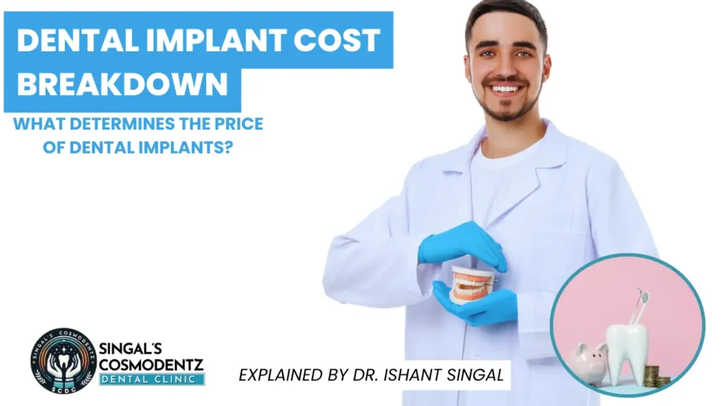 Dental implant cost breakdown chart showing consultation, implant surgery, abutment, crown, and additional procedures involved in dental implant treatment.