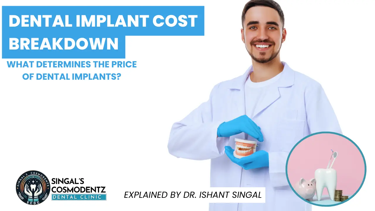 Dental implant cost breakdown chart showing consultation, implant surgery, abutment, crown, and additional procedures involved in dental implant treatment.