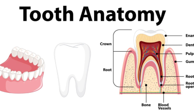 Root Canal Treatment (RCT) in Gurgaon