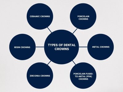 Dental Crowns in Gurgaon: Expert Care