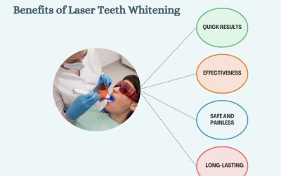 Laser Teeth Whitening in Gurgaon