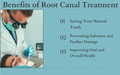 Benefits of Root Canal Treatment
