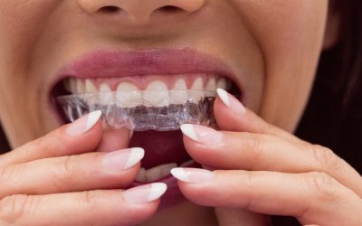 Best Orthodontist in Gurgaon